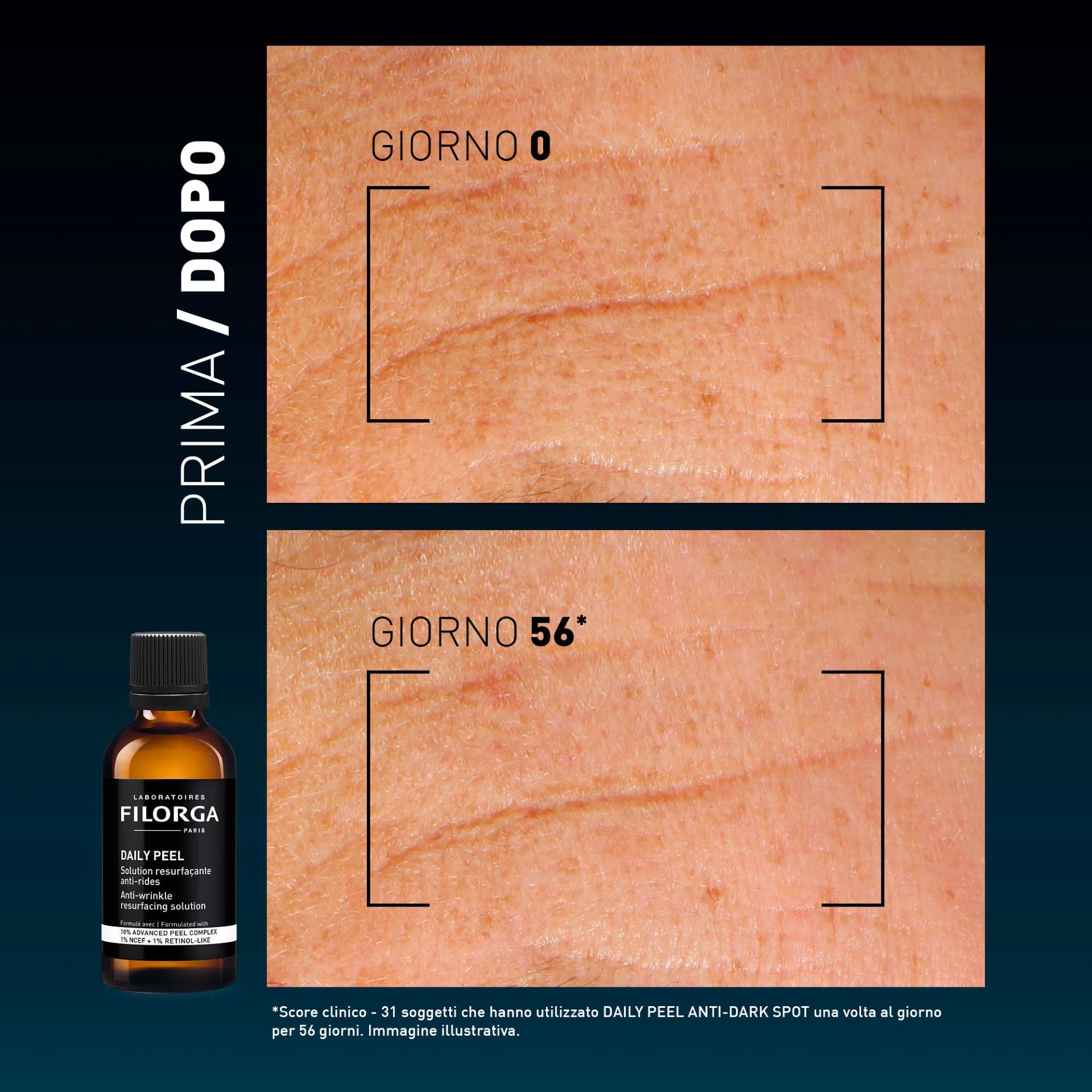 image - 951586130 - Soluzione esfoliante quotidiana ispirata ai peeling professionali, formulata con AHA, attivi retinol-like e complesso NCEF per contrastare rughe e grana irregolare della pelle. - 4859294_18.jpg