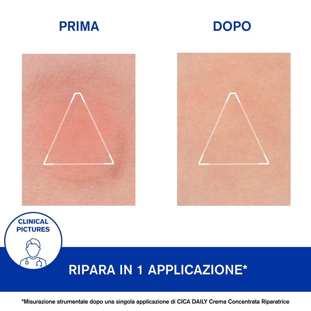 987768292 - CICA DAILY CREMA CONCENTRATA RIPARATRICE 50 ML - 4757700_9.JPG