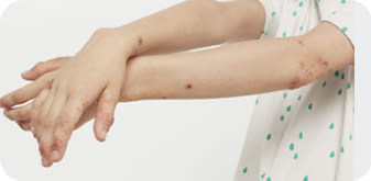 image - dermocosmesi-pelle-irritata