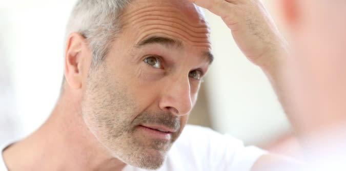 Magazine | Caduta dei capelli rimedi efficaci per combatterla