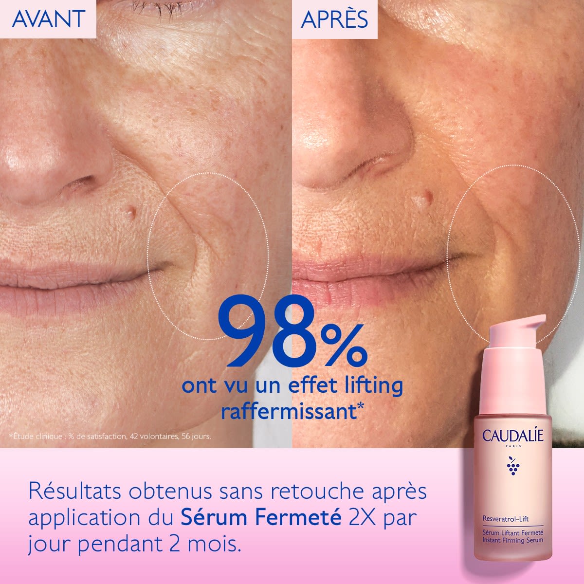 image - 986958294 - RESVERATROL LIFT SIERO RASSODANTE 30 ML - 4744640_5.jpg