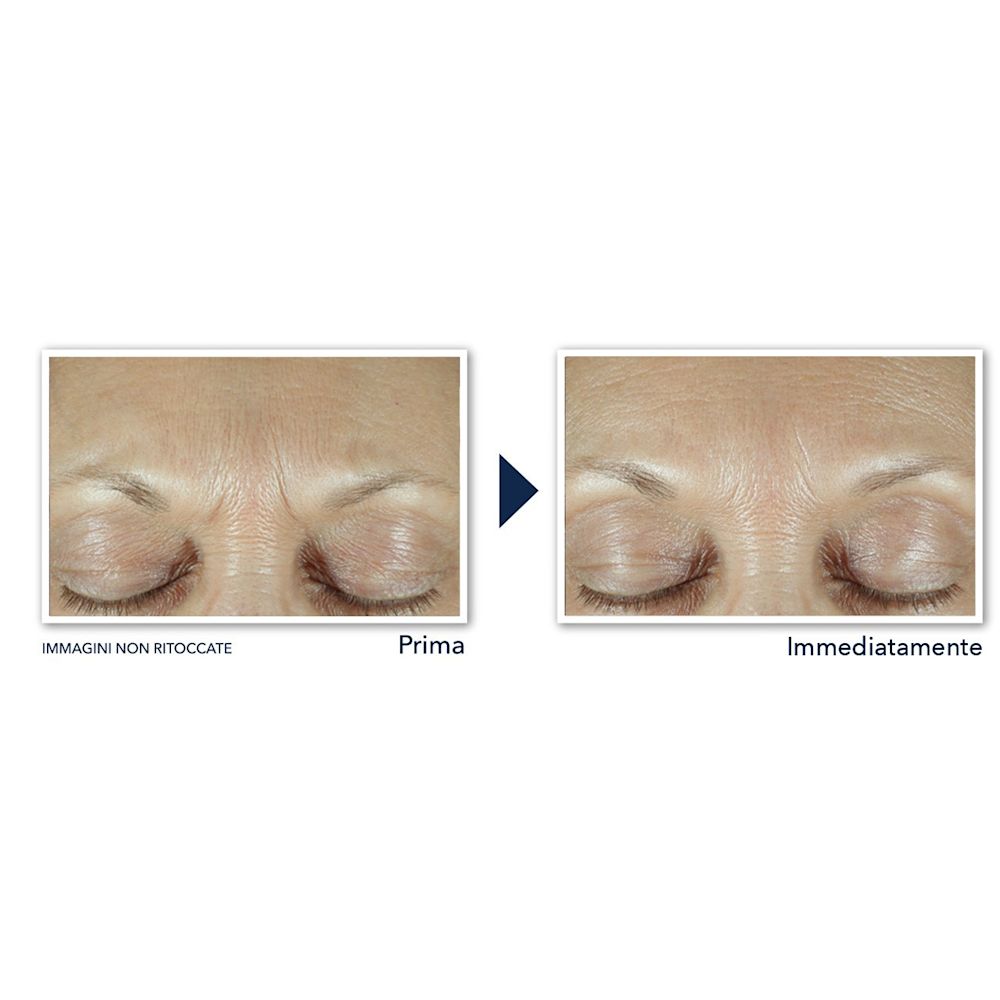 987837616 - ROC DERM CORREXION FILL + TREAT SERUM 15 ML - 4762755_6.jpg