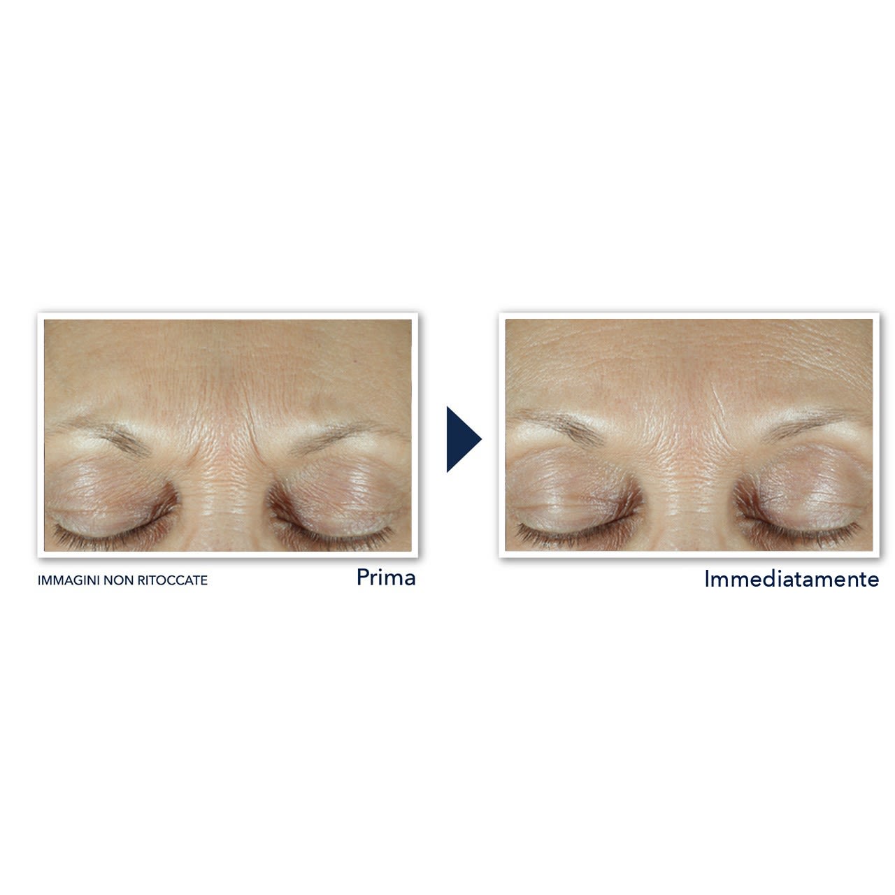 987837616 - ROC DERM CORREXION FILL + TREAT SERUM 15 ML - 4762755_6.jpg