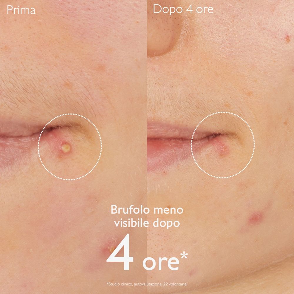 950913653 - VINOPURE SOLUZIONE SALICILICA STOP BRUFOLI 15 ML - 4844548_5.jpg