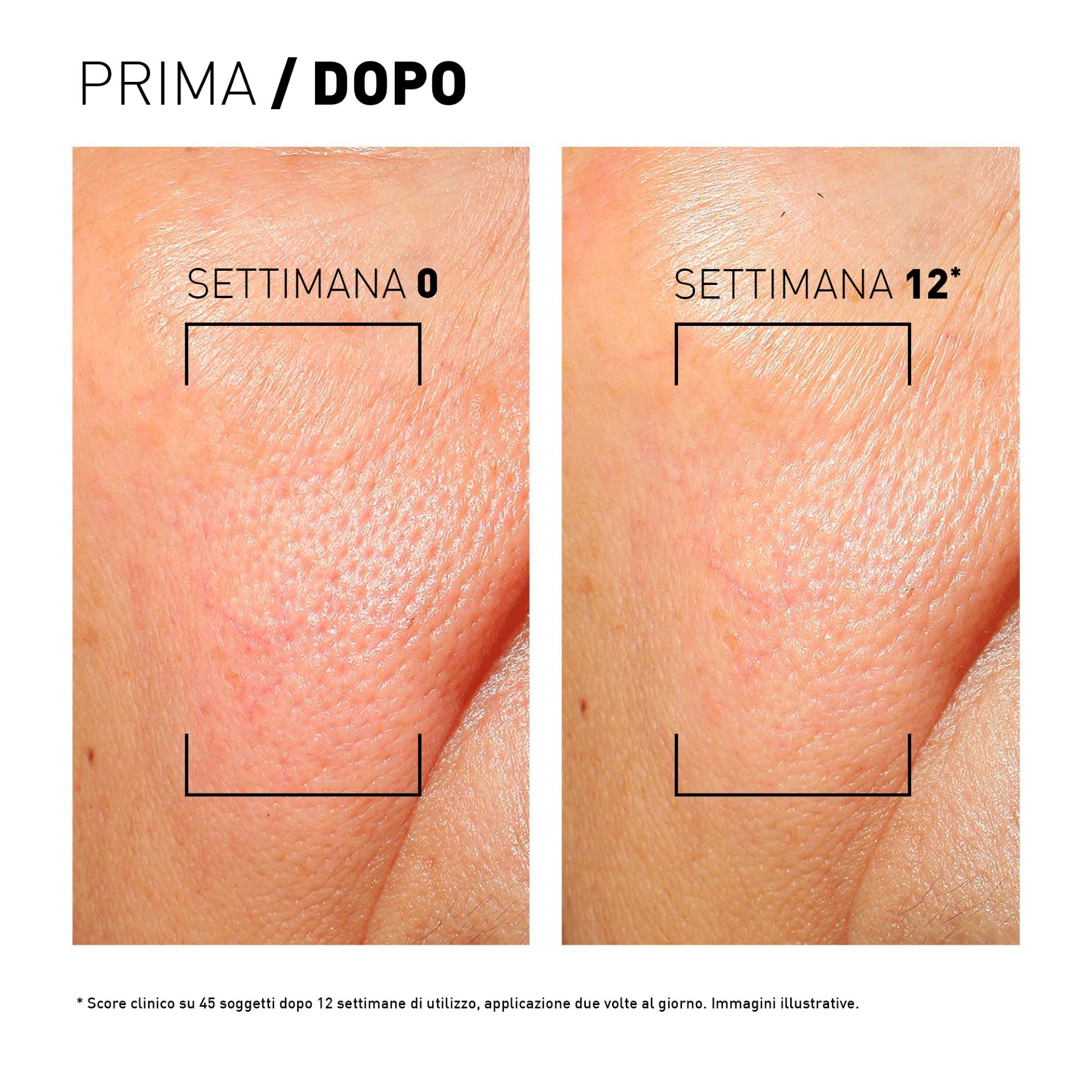 image - 951586142 - Fluido idratante quotidiano con protezione SPF50+ 100% minerale, studiato per proteggere la pelle dai raggi UV e dal fotoinvecchiamento, anche in caso di pelle sensibile o reattiva. - 4859295_18.jpg