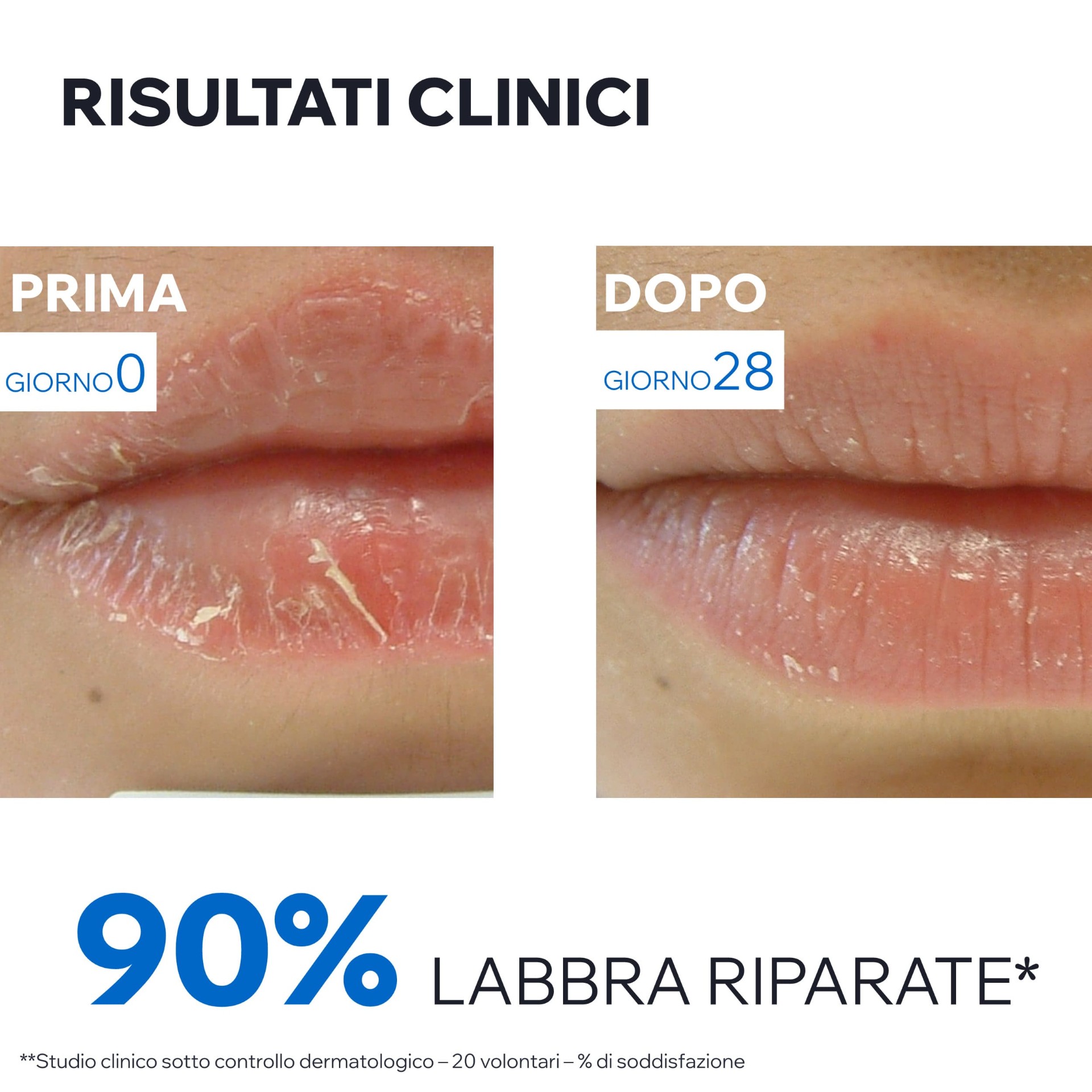 image - 971272556 - BARIEDERM CICA-LEVRES 15 ML - 7871422_11.jpg