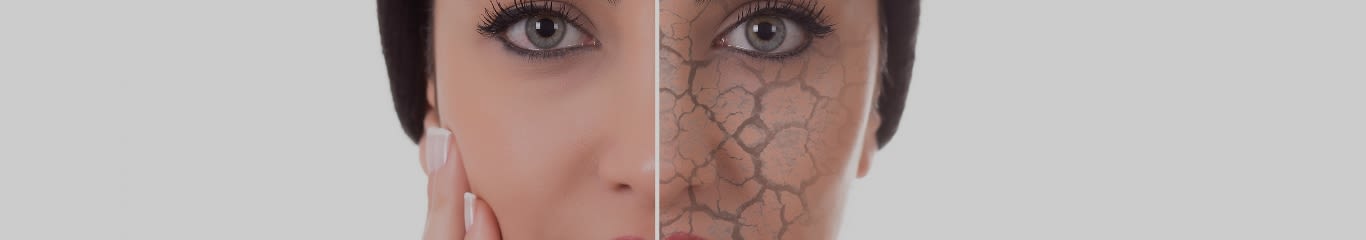 Skincare per pelle secca: ingredienti chiave e routine ideale