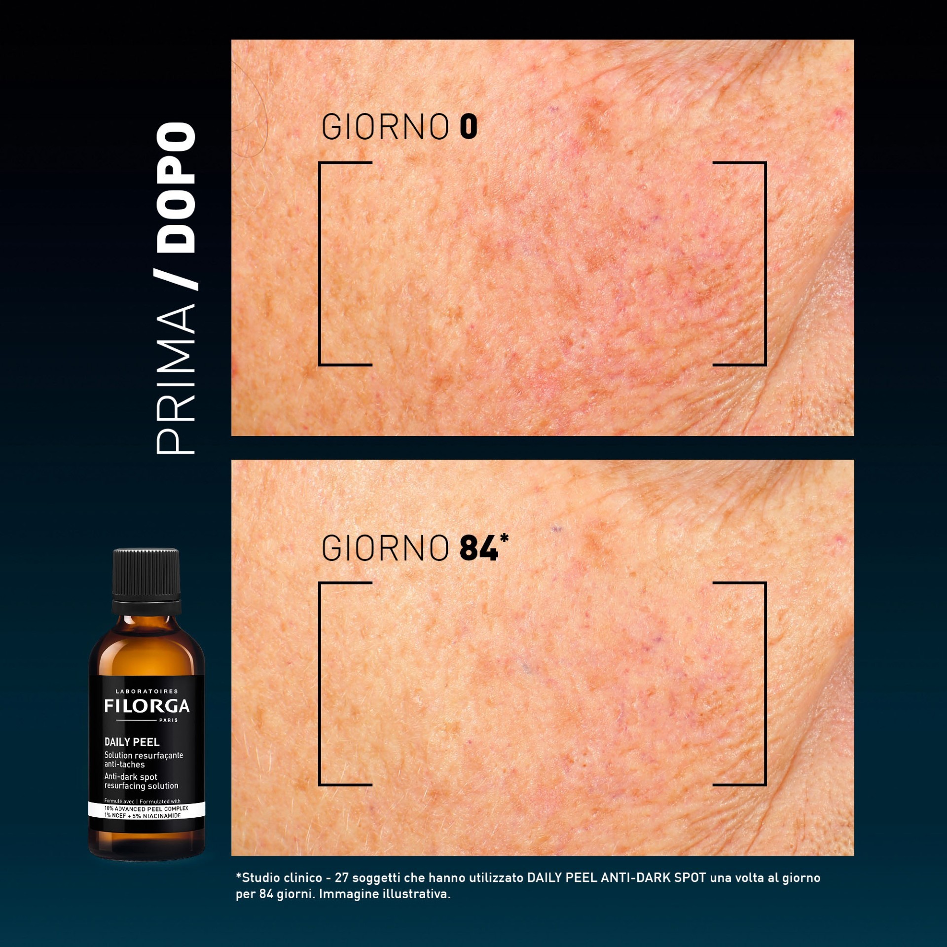 image - 951586128 - Soluzione esfoliante quotidiana ispirata ai peeling professionali, formulata con acidi AHA, niacinamide e acido tranexamico per ridurre macchie e discromie cutanee. - 4859293_18.jpg