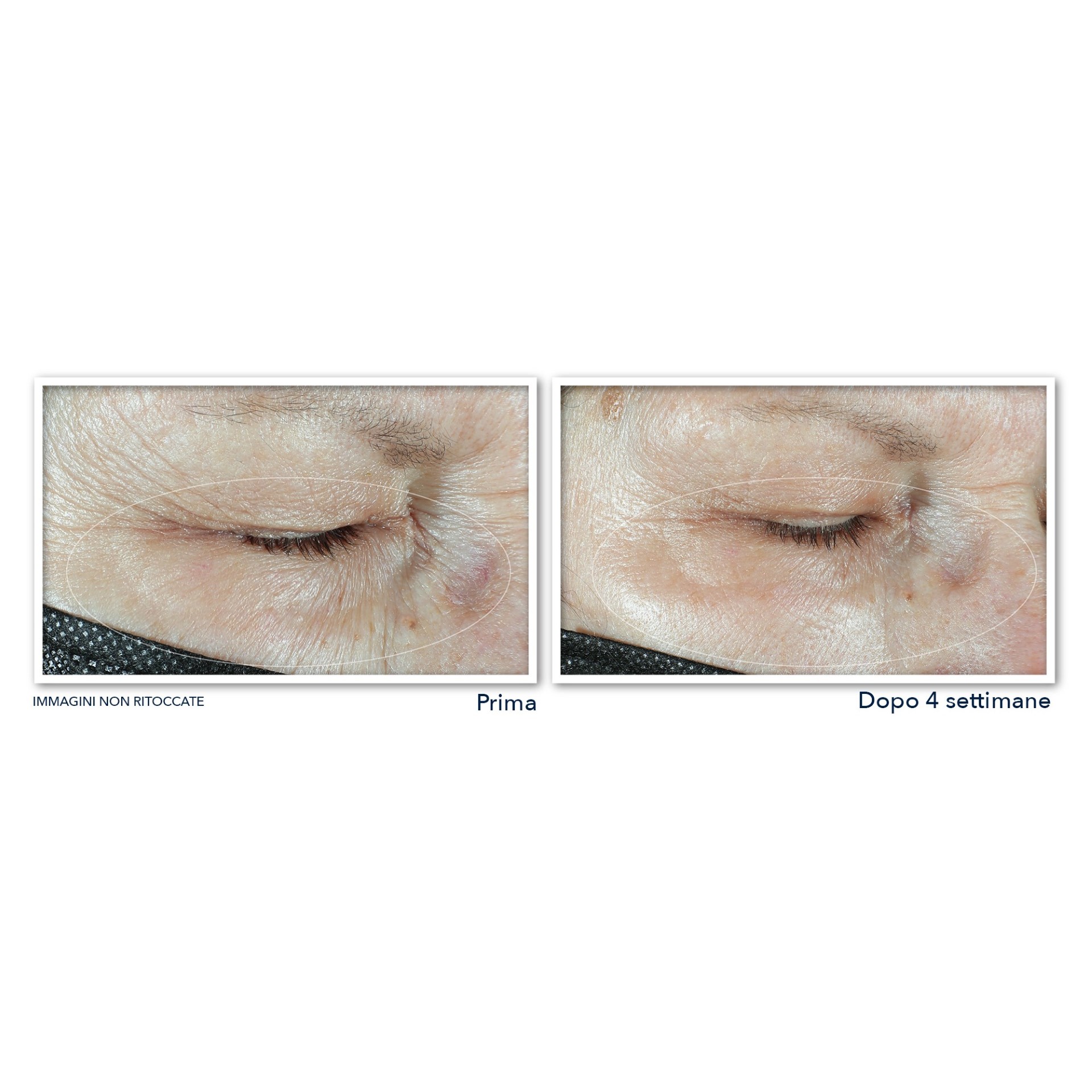 983530080 - ROC MULTI CORREXION HYDRATE+ PLUMP CREMA OCCHI 15 ML - 4739841_7.jpg