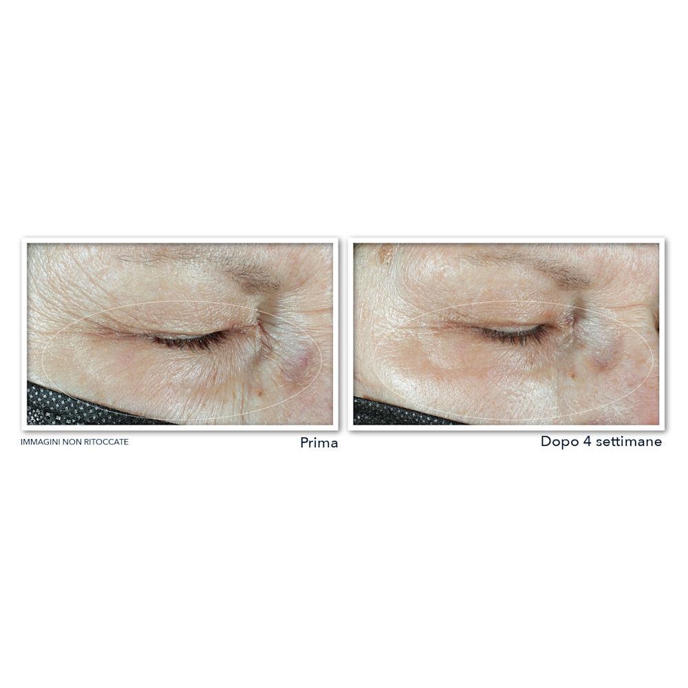 983530080 - ROC MULTI CORREXION HYDRATE+ PLUMP CREMA OCCHI 15 ML - 4739841_7.jpg