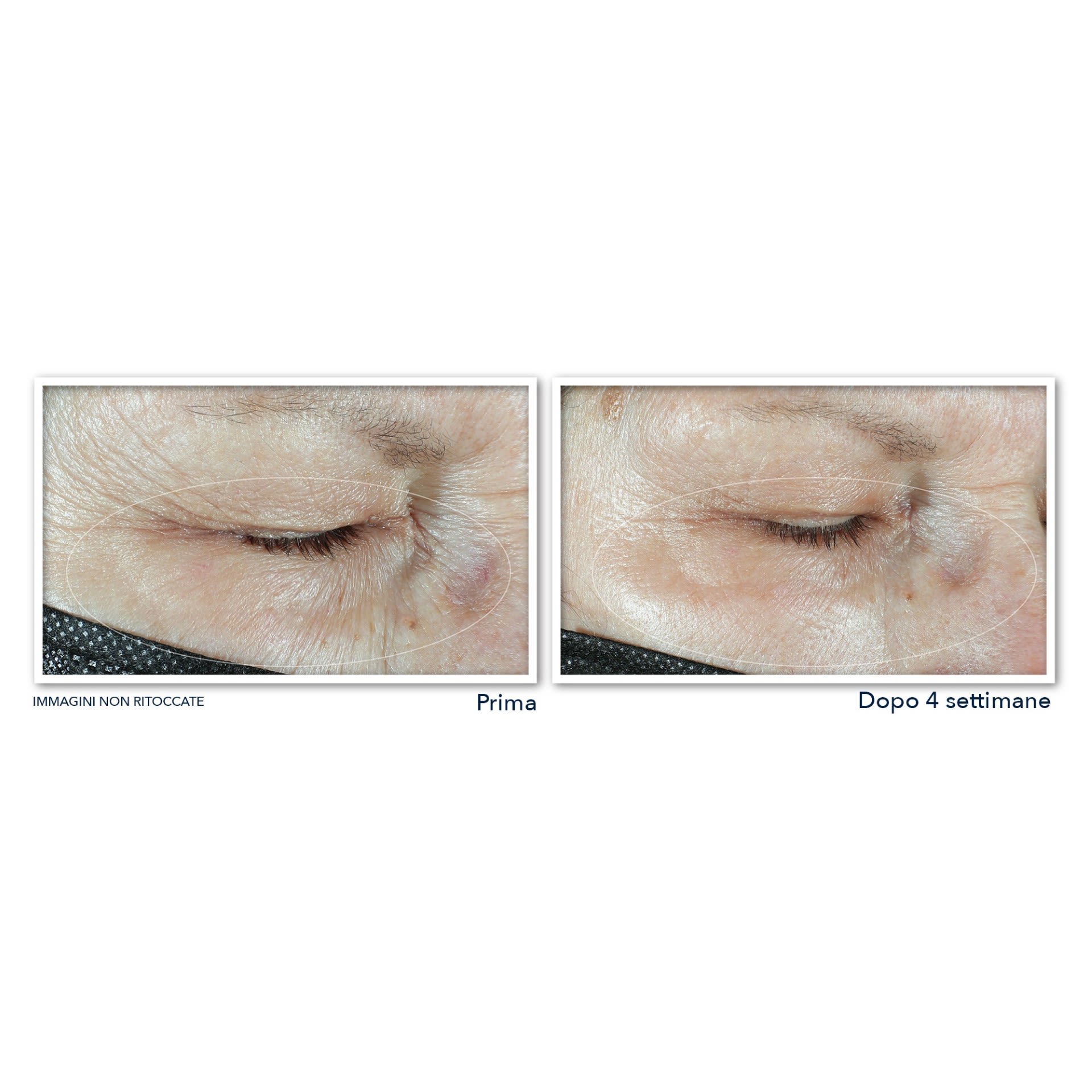 image - 983530080 - ROC MULTI CORREXION HYDRATE+ PLUMP CREMA OCCHI 15 ML - 4739841_7.jpg