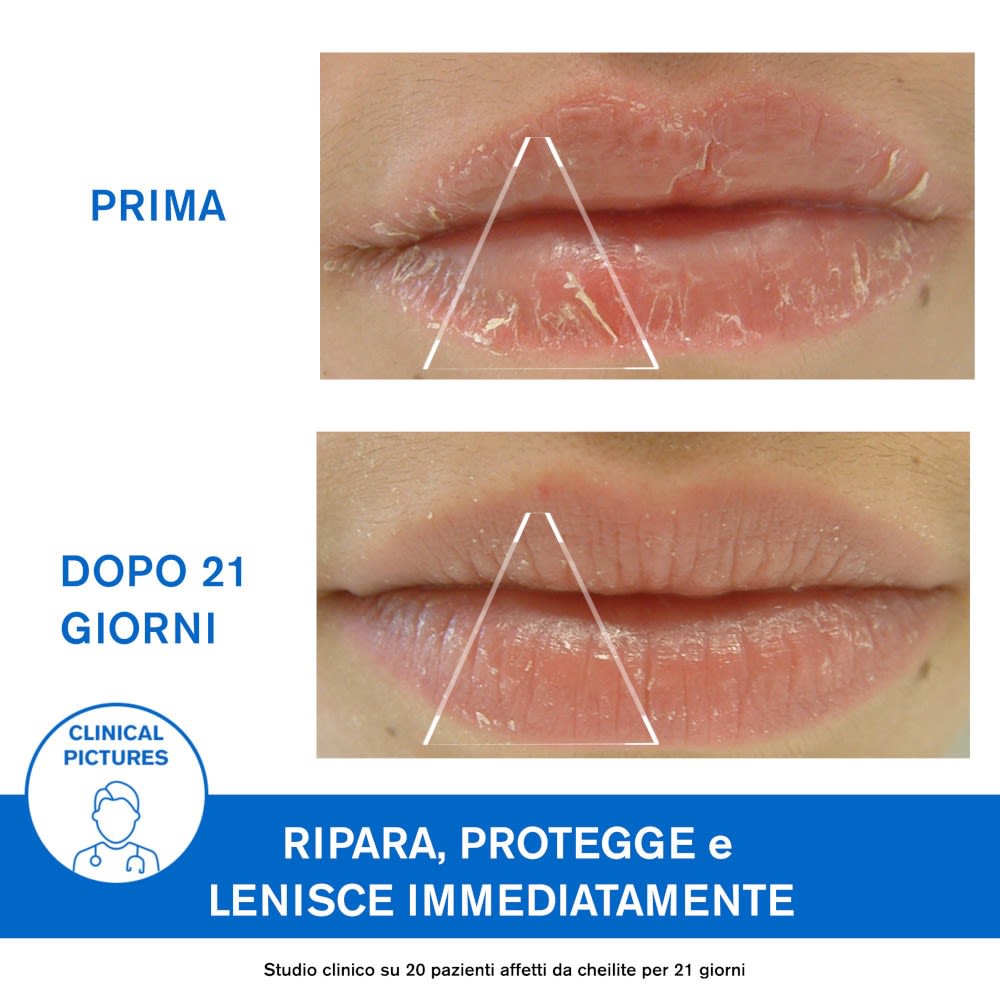 image - 971272556 - BARIEDERM CICA-LEVRES 15 ML - 7871422_9.jpg