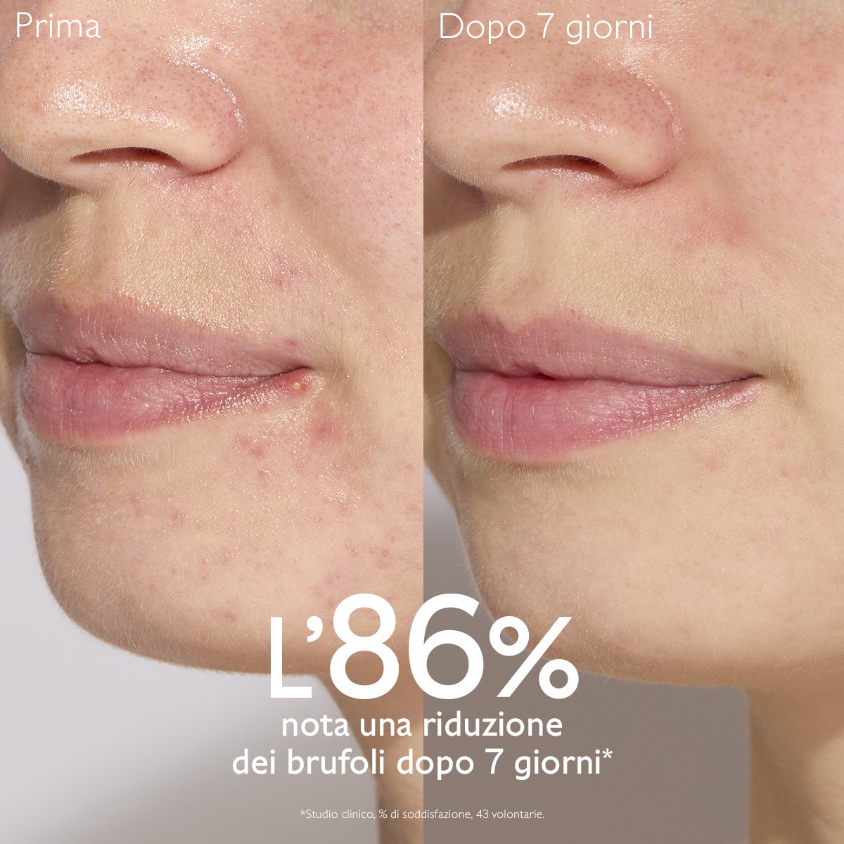 image - 950913640 - VINOPURE SIERO ANTI IMPERFEZIONI 30 ML - 4844547_7.jpg