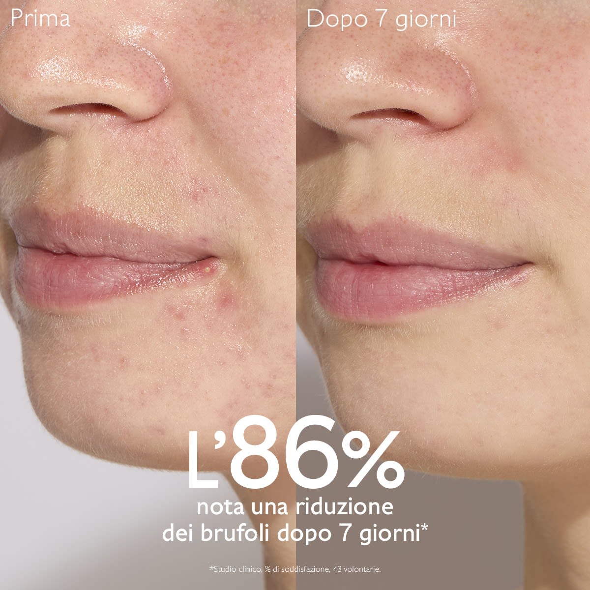 950913640 - VINOPURE SIERO ANTI IMPERFEZIONI 30 ML - 4844547_7.jpg