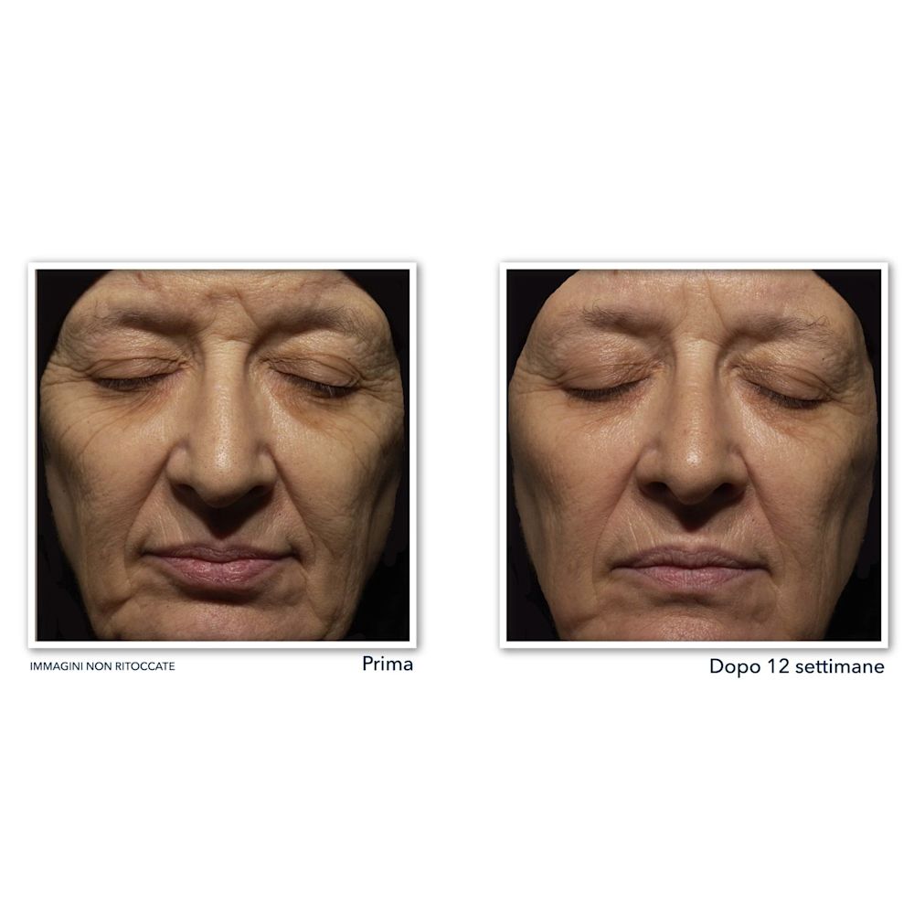 980923054 - ROC RETINOL CORREXION WRINKLE CORRECT CREMA VISO NOTTE 30 ML - 4737040_6.jpg