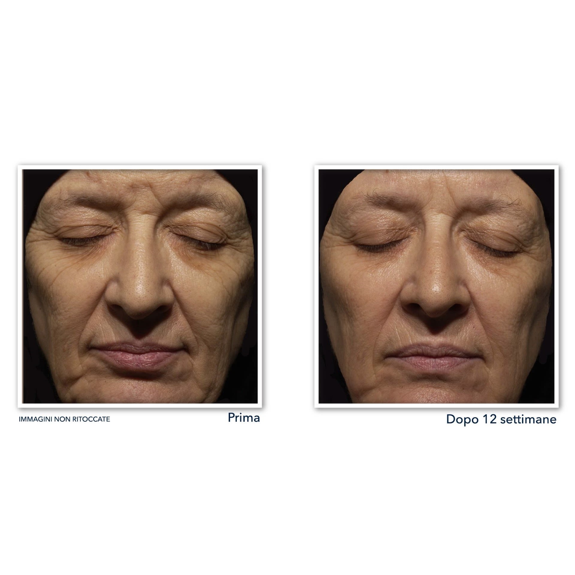 980923054 - ROC RETINOL CORREXION WRINKLE CORRECT CREMA VISO NOTTE 30 ML - 4737040_6.jpg