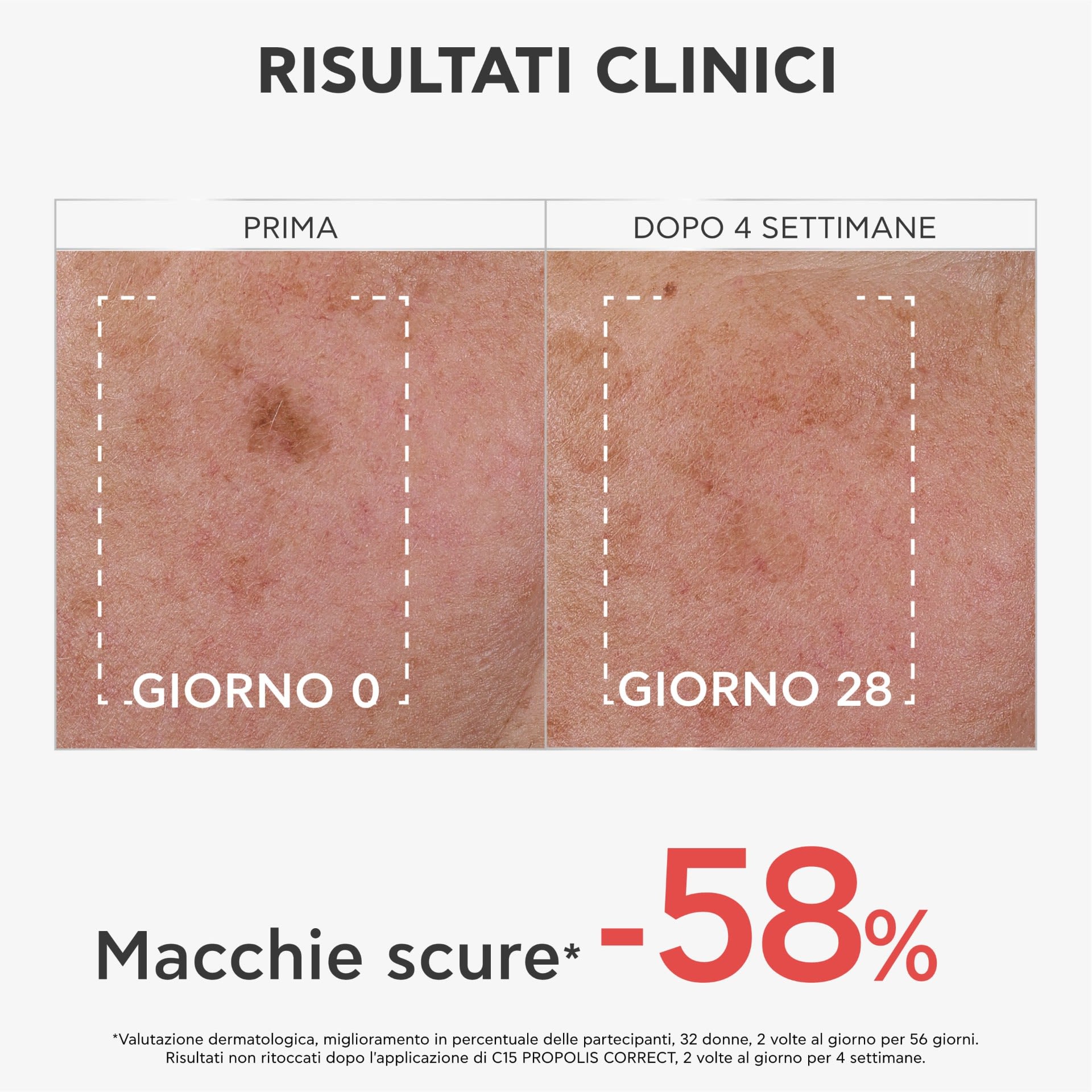 950213076 - APIVITA BEE TECH CONCENTRATE C15 PROPOLIS CORRECT SERUM 30 ML - 4812925_9.jpg