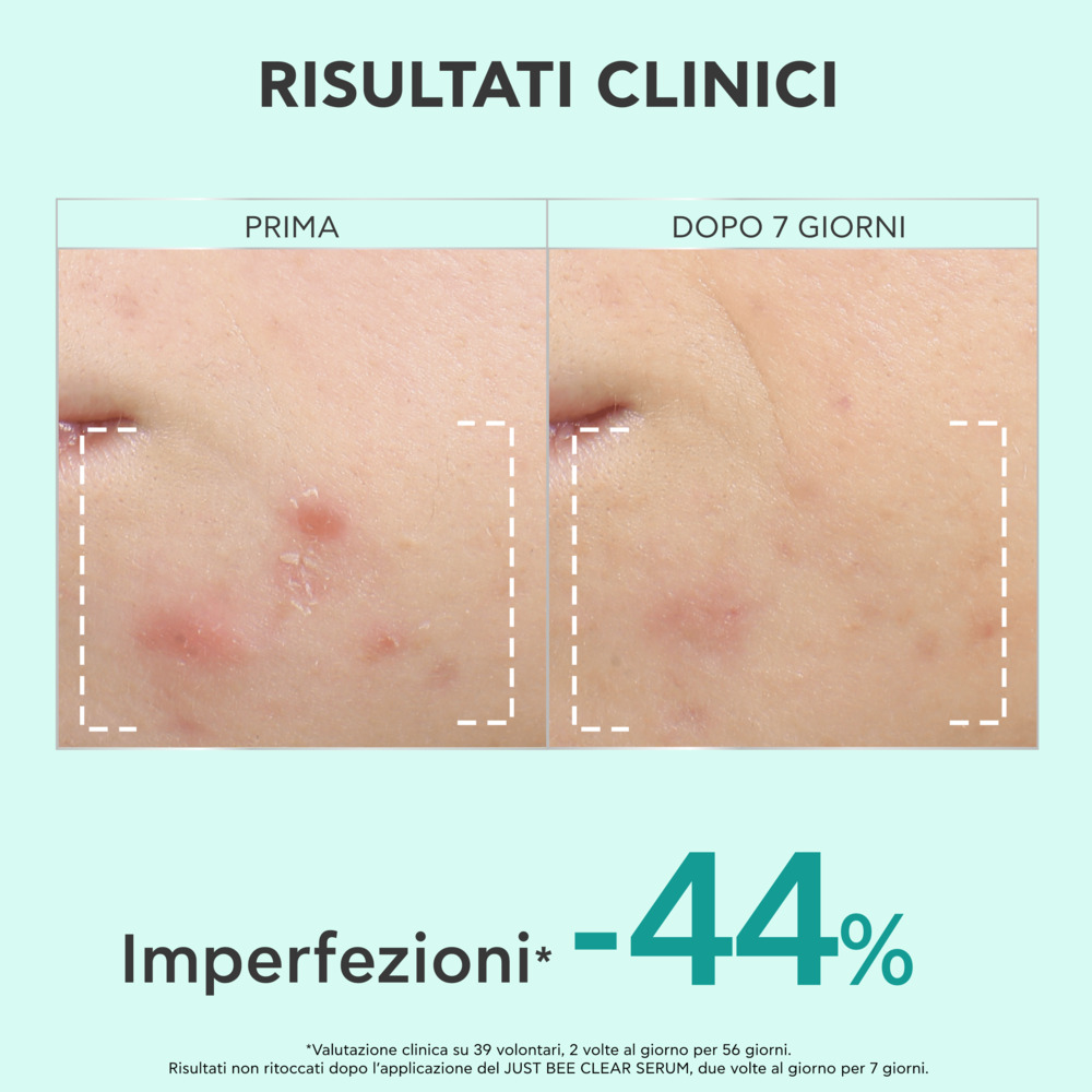 image - 951888460 - Siero perfezionatore Apivita Just Bee Clear, aiuta ad affinare la grana della pelle e ridurre macchie e imperfezioni. - 4864049_6.jpg