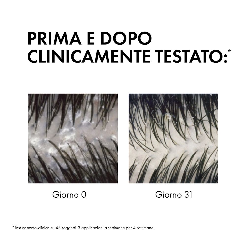 image - 984622922 - DERCOS ECO RICARICA SHAMPOO ANTI FORFORA 500 ML - 4740983_5.jpg