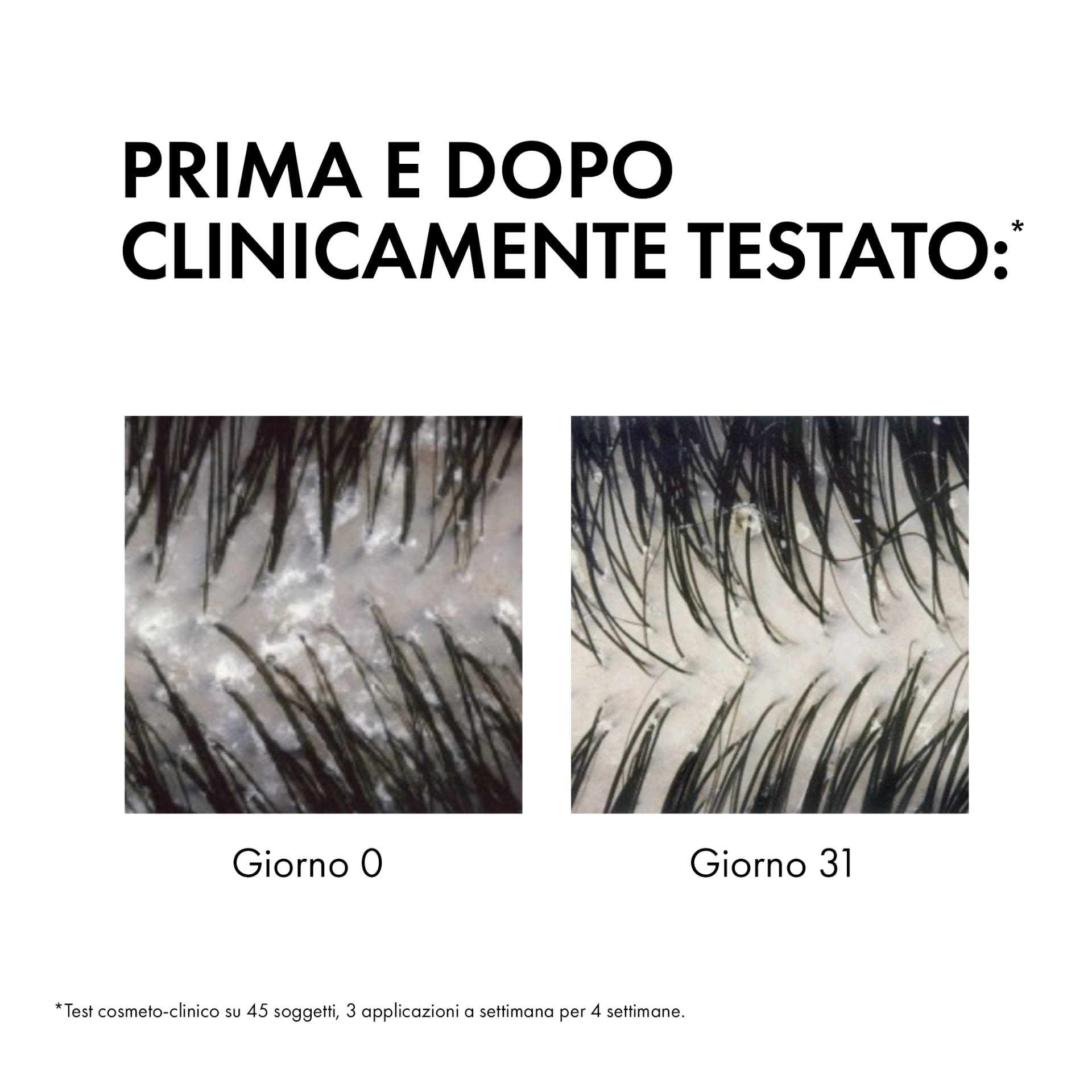 image - 984622922 - DERCOS ECO RICARICA SHAMPOO ANTI FORFORA 500 ML - 4740983_5.jpg