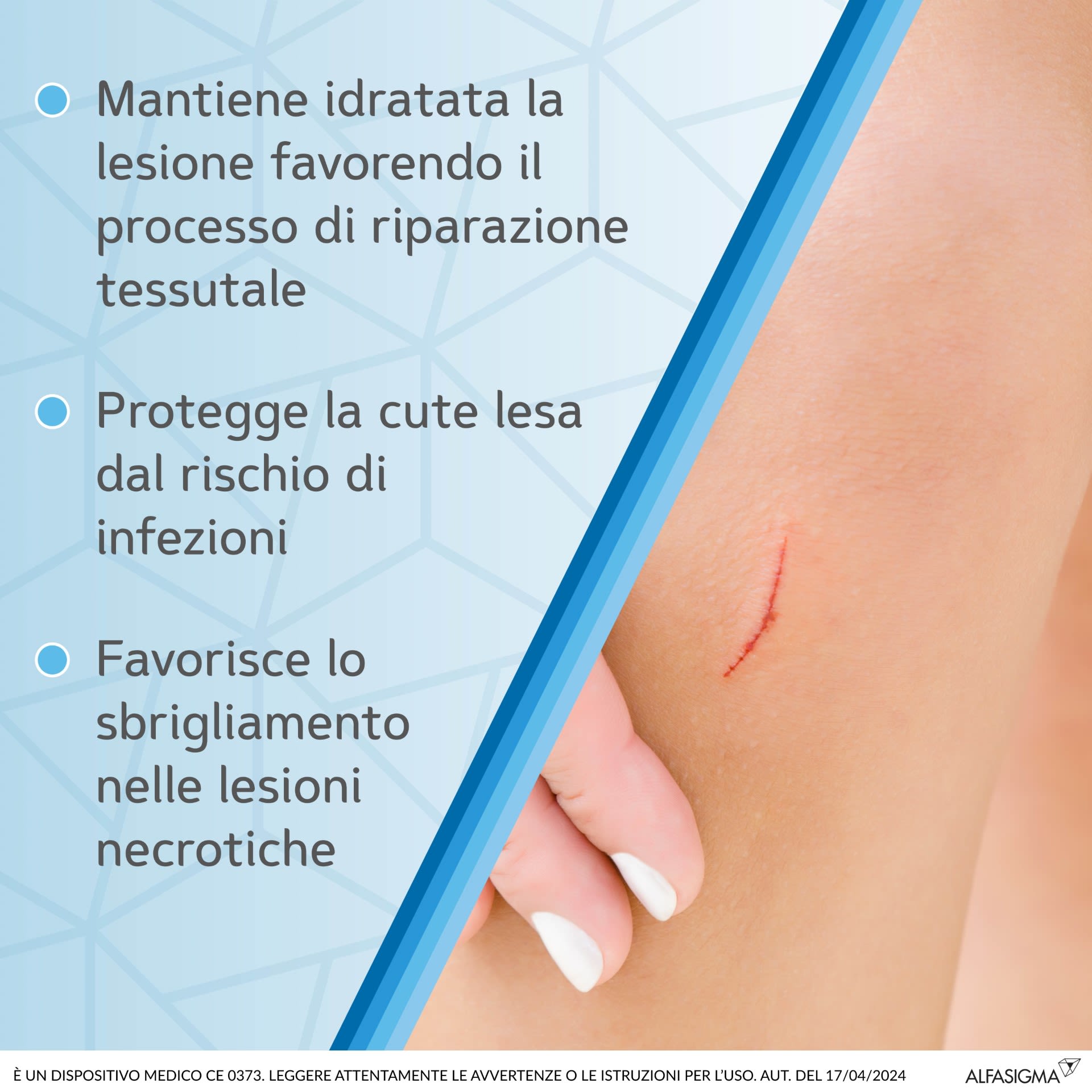 image - 983036258 - MEDICAZIONE SOFARGEN GEL ACIDO IALURONICO E ARGENTO SULFADIAZINA 25 G - 4739339_5.jpg