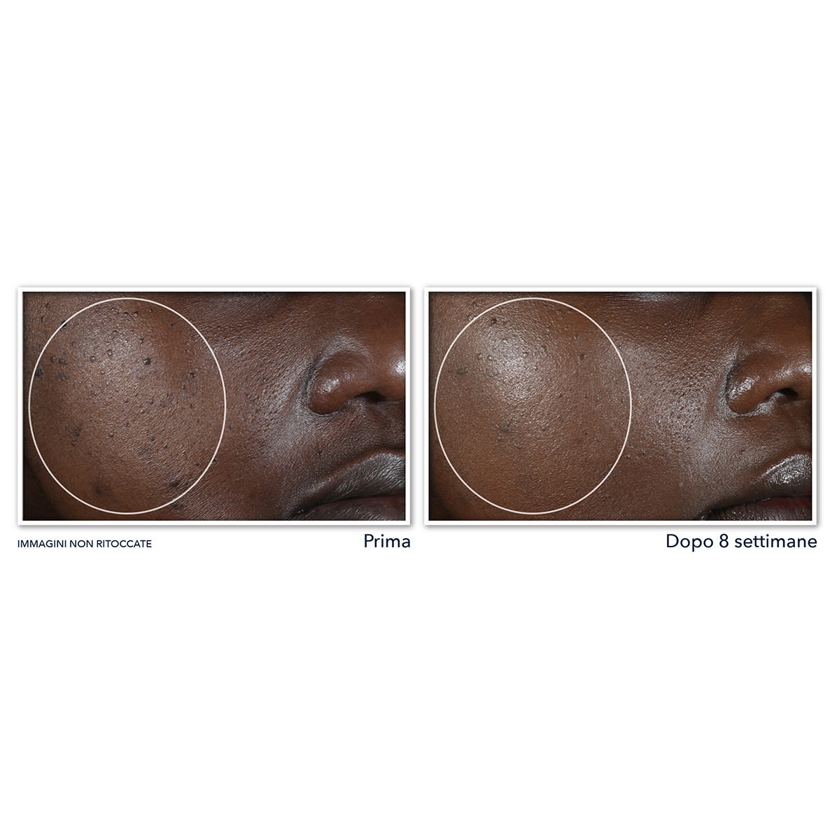 987066949 - ROC MULTI CORREXION EVEN TONE + LIFT NIGHT CREAM 50 ML - 4745728_5.jpg