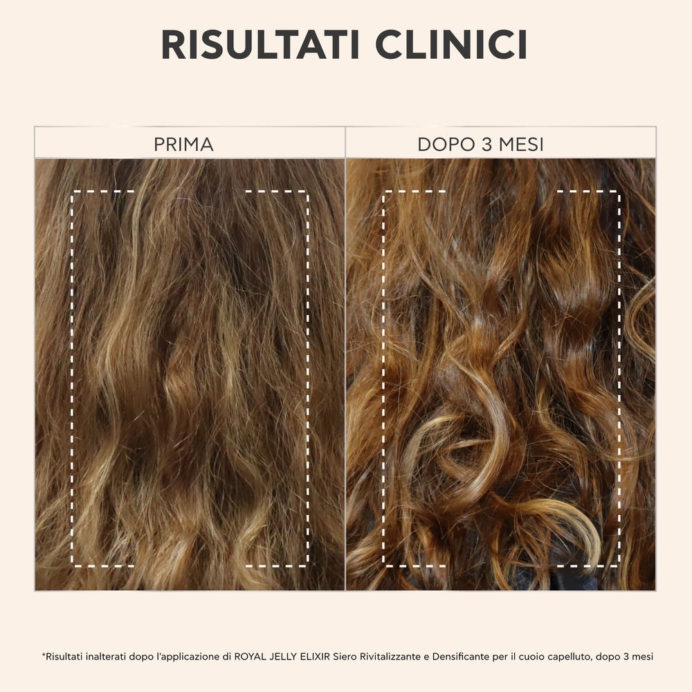 950213052 - APIVITA ROYAL JELLY ELIXIR SCALP SIERO 50 ML - 4812923_11.jpg