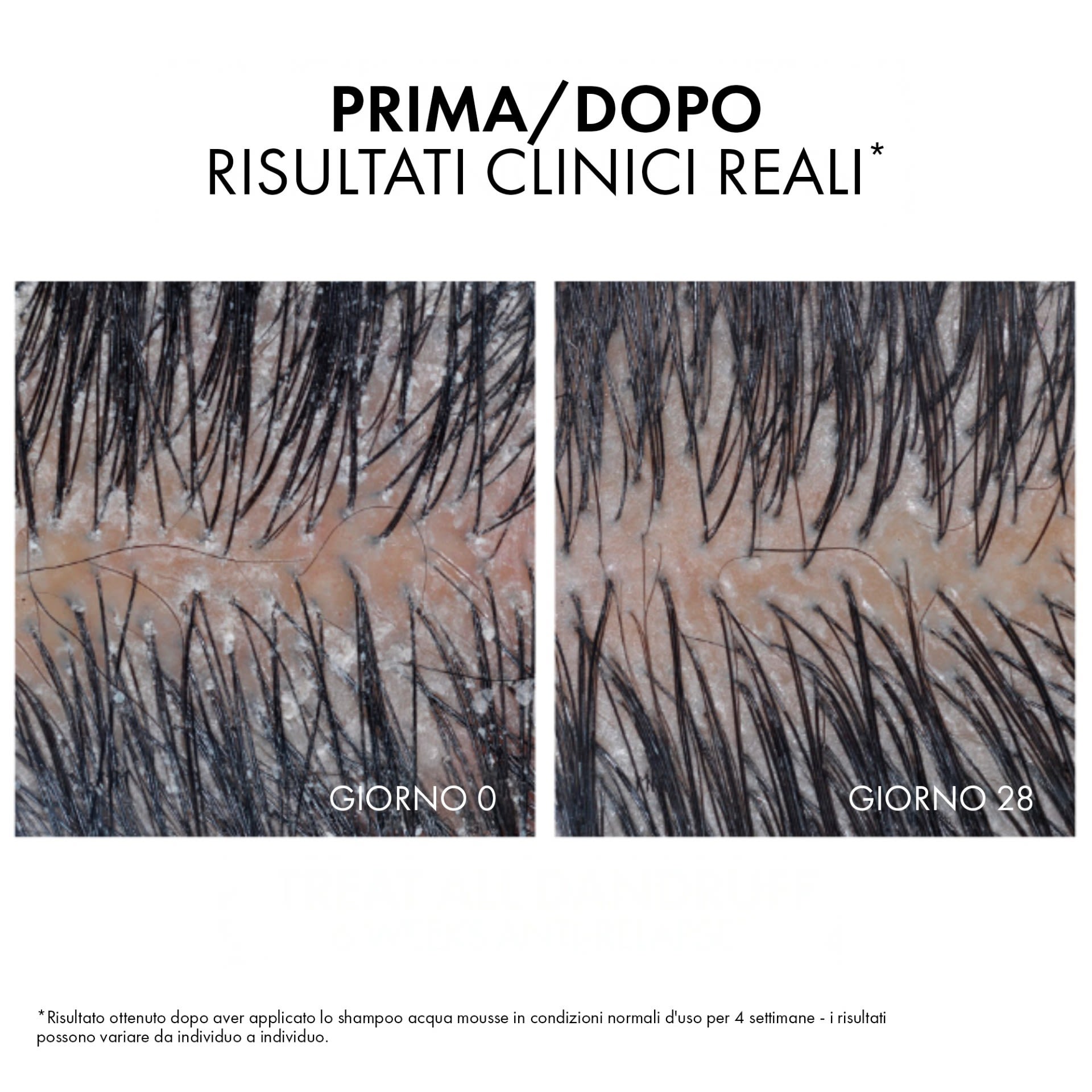 image - 950130652 - DERCOS TECHNIQUE SHAMPOO ANTI DANDRUFF ACQUA MOUSSE 200 ML - 4812573_14.jpg