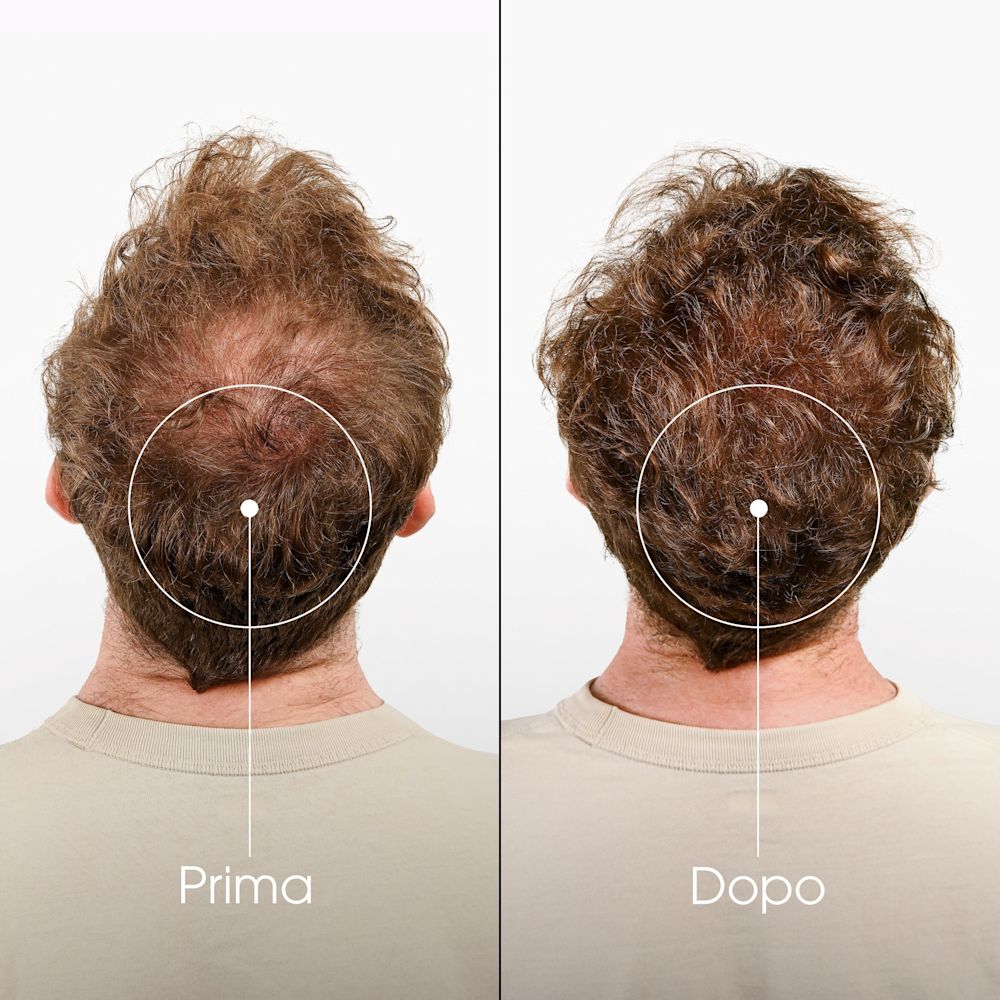 image - 981971070 - shampoo chinina e stella alpina descrizione - 4707963_7.jpg