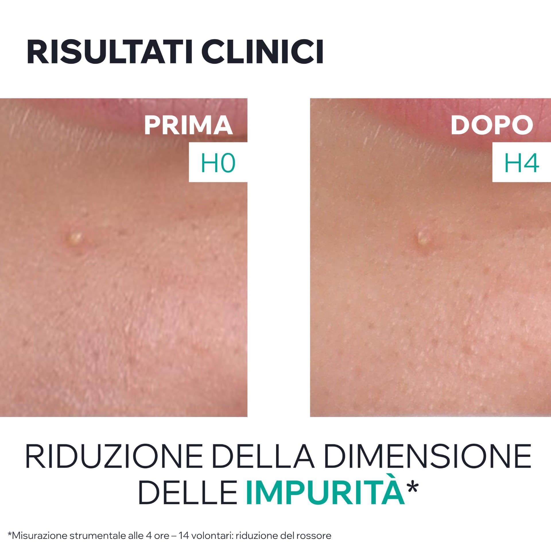 image - 988988578 - HYSEAC GEL SOS PURIFICANTE 15 ML - 4789122_7.jpg