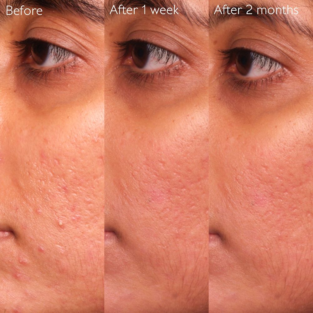 image - 950913640 - VINOPURE SIERO ANTI IMPERFEZIONI 30 ML - 4844547_9.jpg