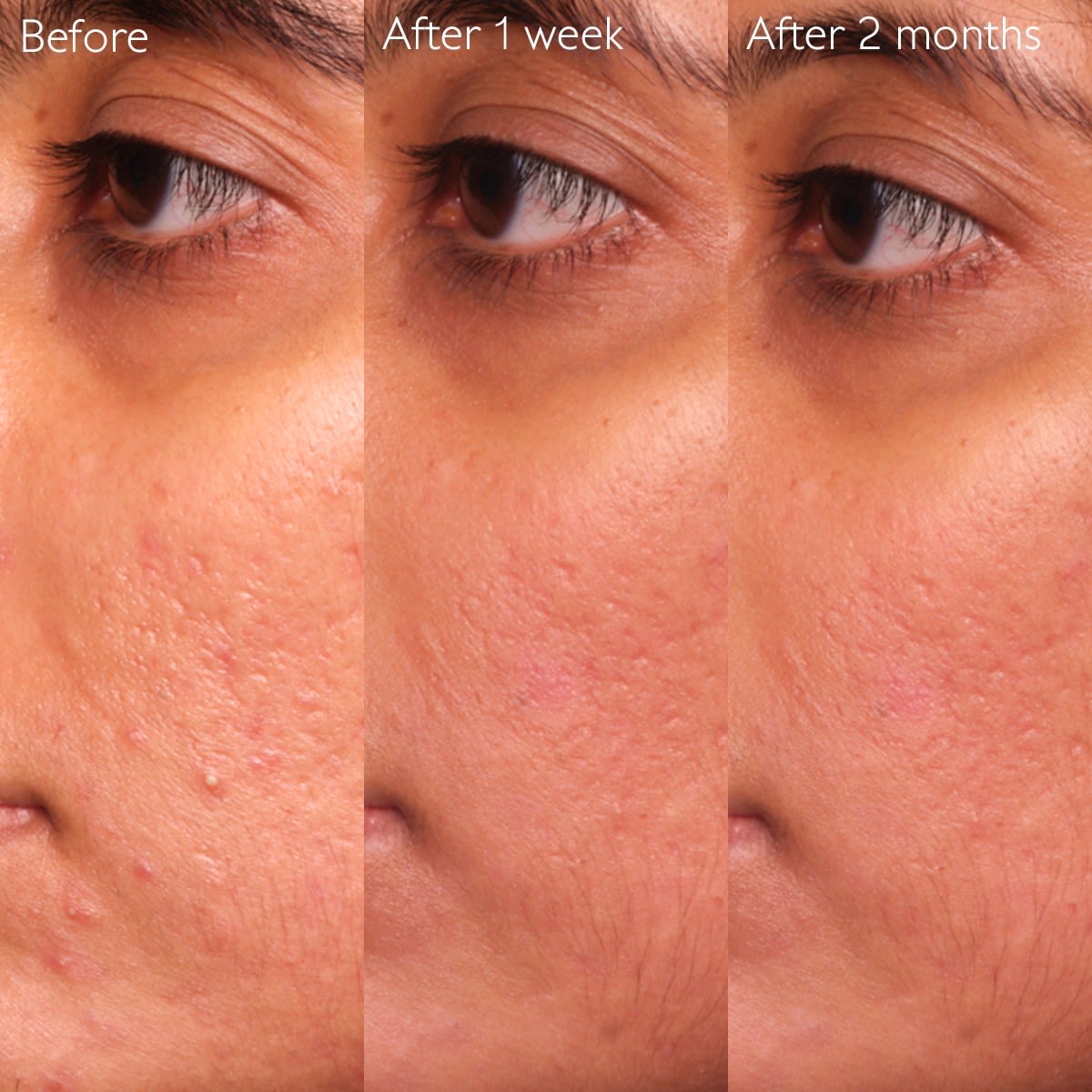 image - 950913640 - VINOPURE SIERO ANTI IMPERFEZIONI 30 ML - 4844547_9.jpg