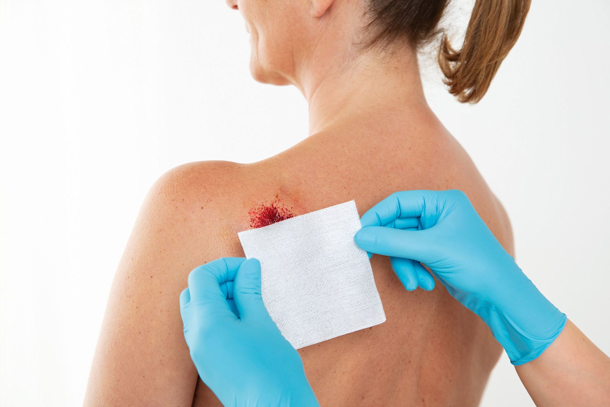 image - 973293158 - Leukoplast Fixomull Stretch 5cmx5m - 7889101_5.jpg