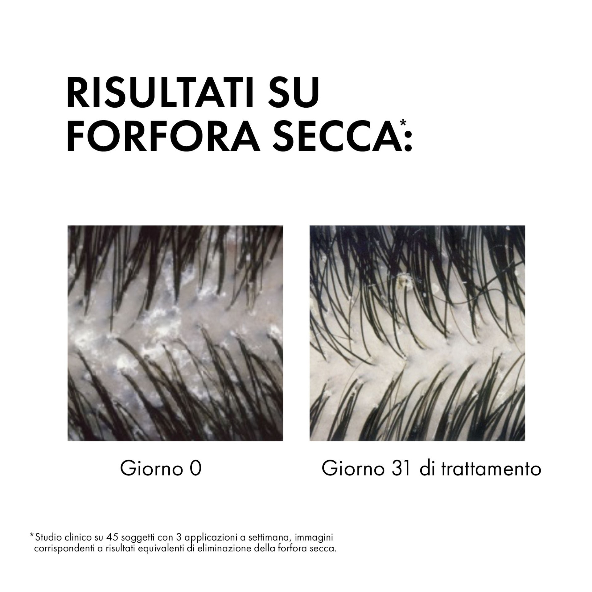 972067957 - DERCOS SHAMPO ANTIFORFORA SECCHI 390 ML - 4812588_5.jpg