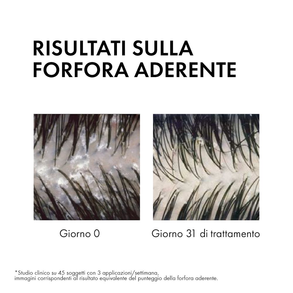 926568155 - DERCOS SHAMPO ANTIFORFORA GRASSI 200 ML - 7870391_6.jpg