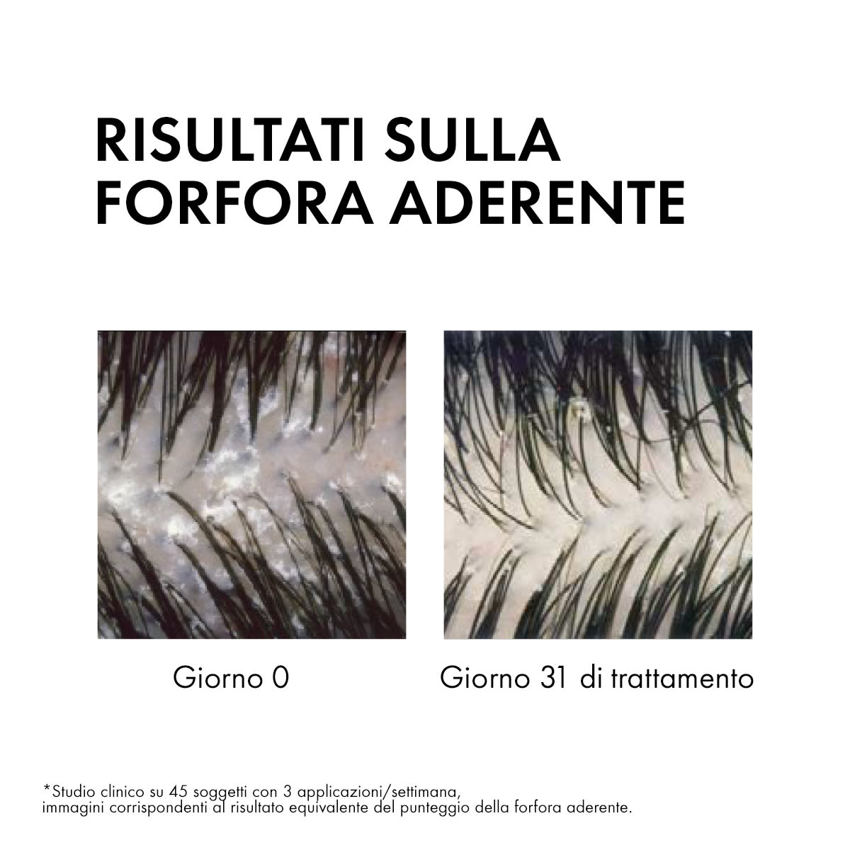 image - 926568155 - DERCOS SHAMPO ANTIFORFORA GRASSI 200 ML - 7870391_6.jpg