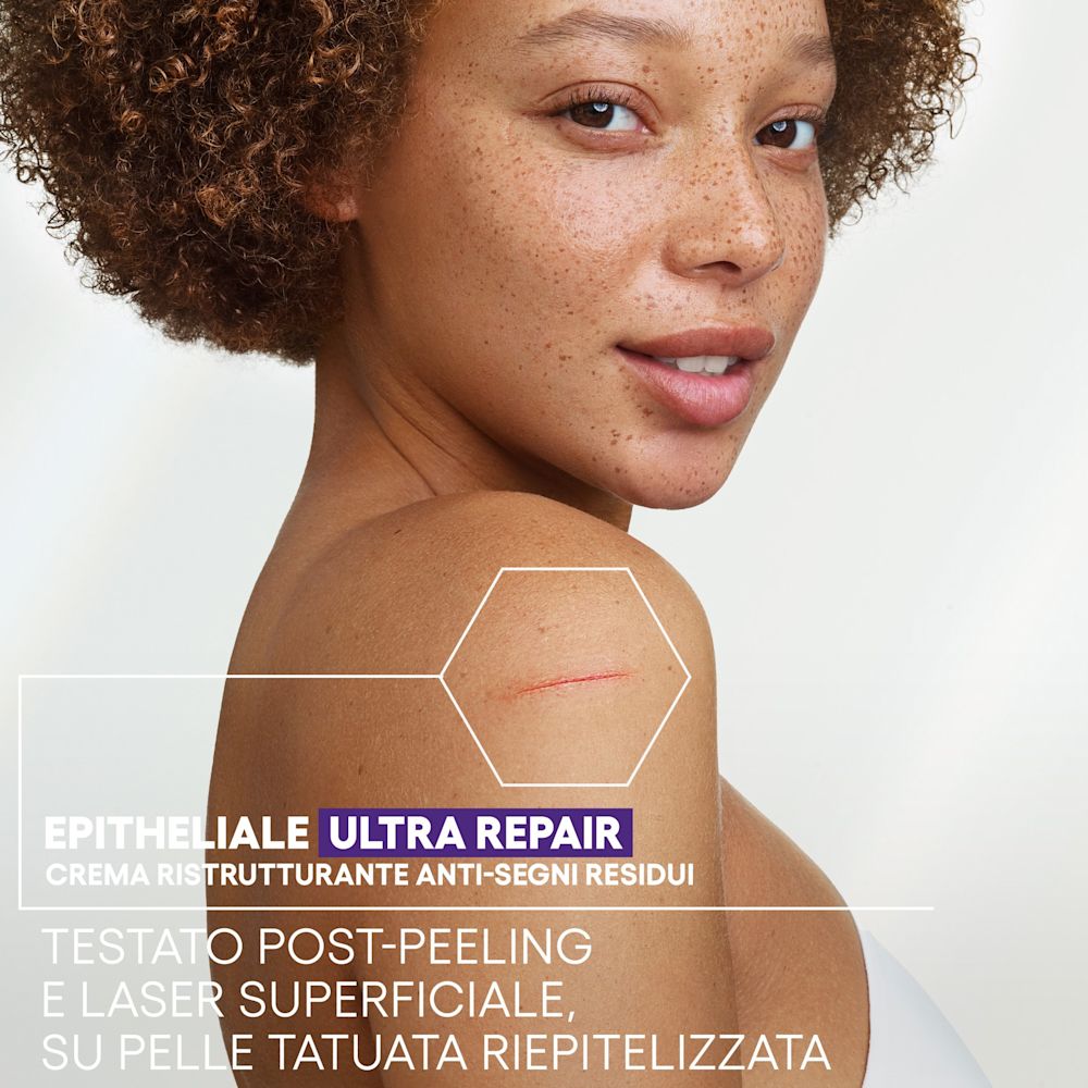 950406722 - EPITHELIALE ULTRA REPAIR CREMA RISTRUTTURANTE ANTI SEGNI RESIDUI 40 ML - 4836333_4.jpg