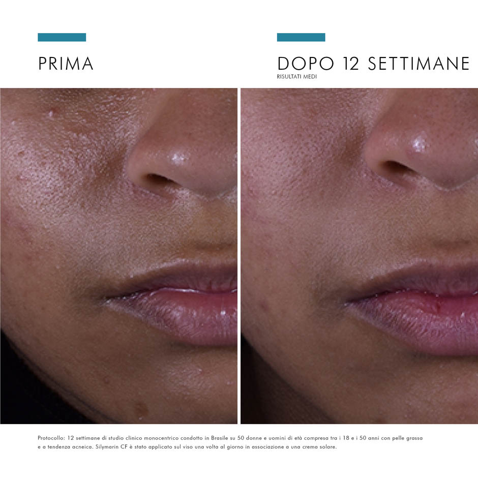 981150333 - SILYMARIN CF 30 ML - 4706532_12.jpg