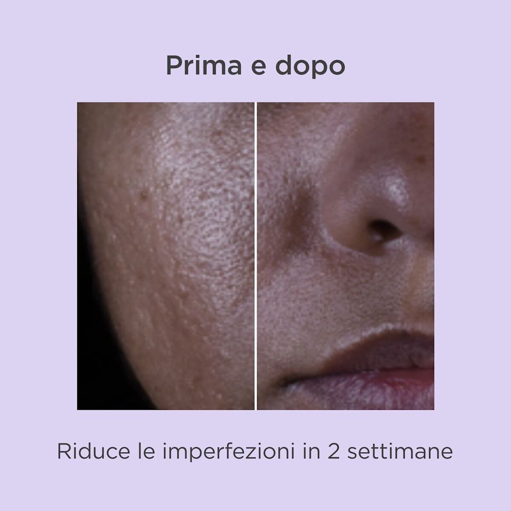 947384703 - ISDINCEUTICS SALICYLIC RENEWAL 30 ML - 4767314_8.jpg
