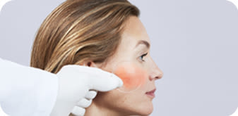 image - dermocosmesi-pelle-rossori