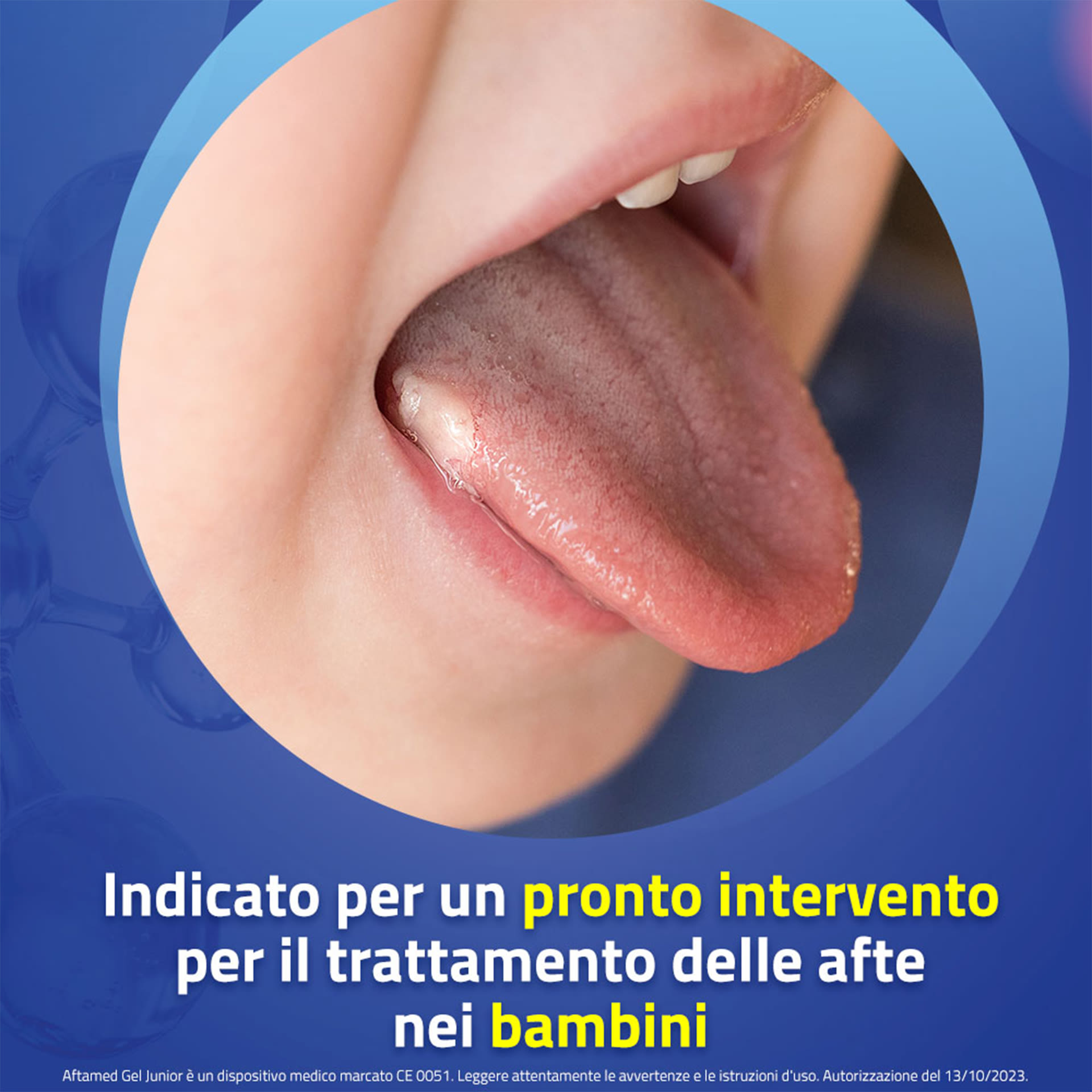 943303519 - GEL AFTAMED JUNIOR ACIDO IALURONICO 10 ML - 4799495_6.jpg