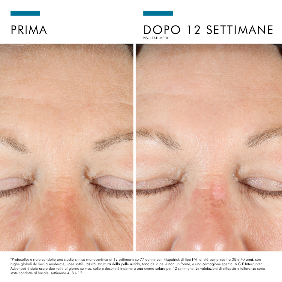 985774518 - AGE EYE COMPLEX 15 ML - 4710978_6.jpg