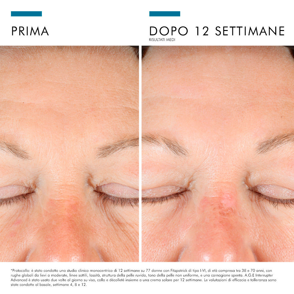 985774518 - AGE EYE COMPLEX 15 ML - 4710978_6.jpg