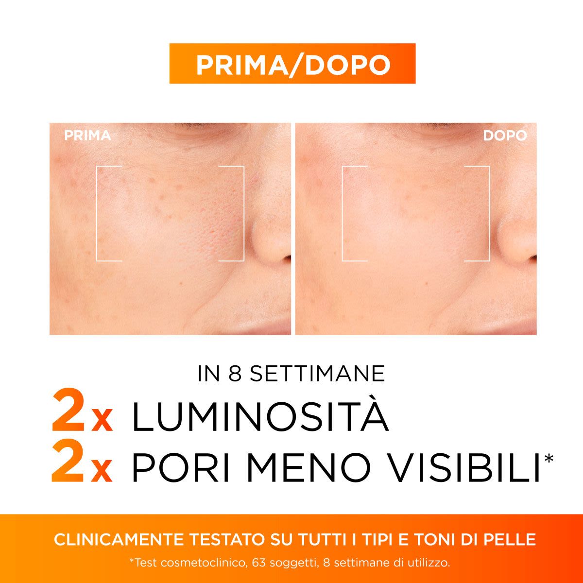 986035448 - L'Oreal Paris Revitalift Clinical 12% pura Vitamina C Siero Viso Discromie Pori Rughe 30ml - 4742904_4.jpg