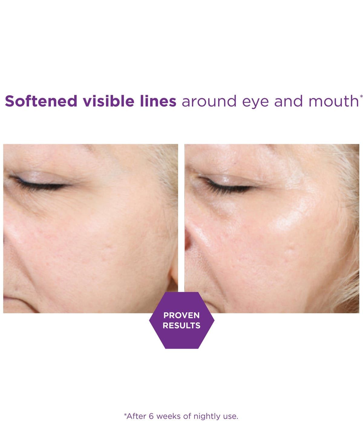 image - 982282547 - Neostrata Retinol Night Serum Siero notte antietà 30ml - 4738276_2.jpg