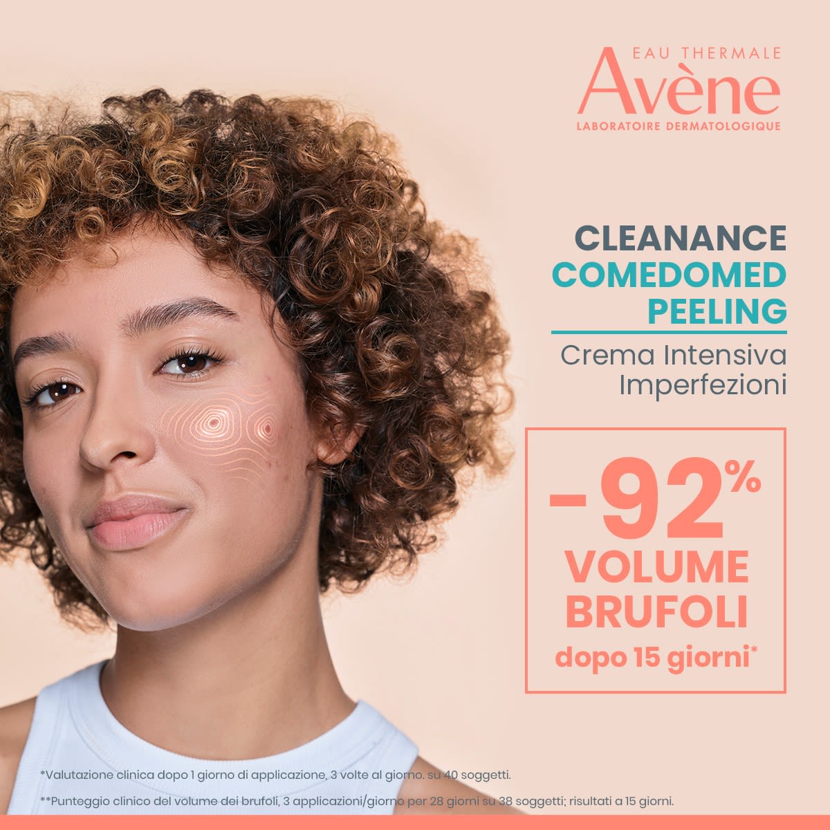 image - 989048970 - AVENE CLEANANCE COMEDOMED PEELING CREMA INTENSIVA IMPERFEZIONI 40 ML - 4787704_5.jpg