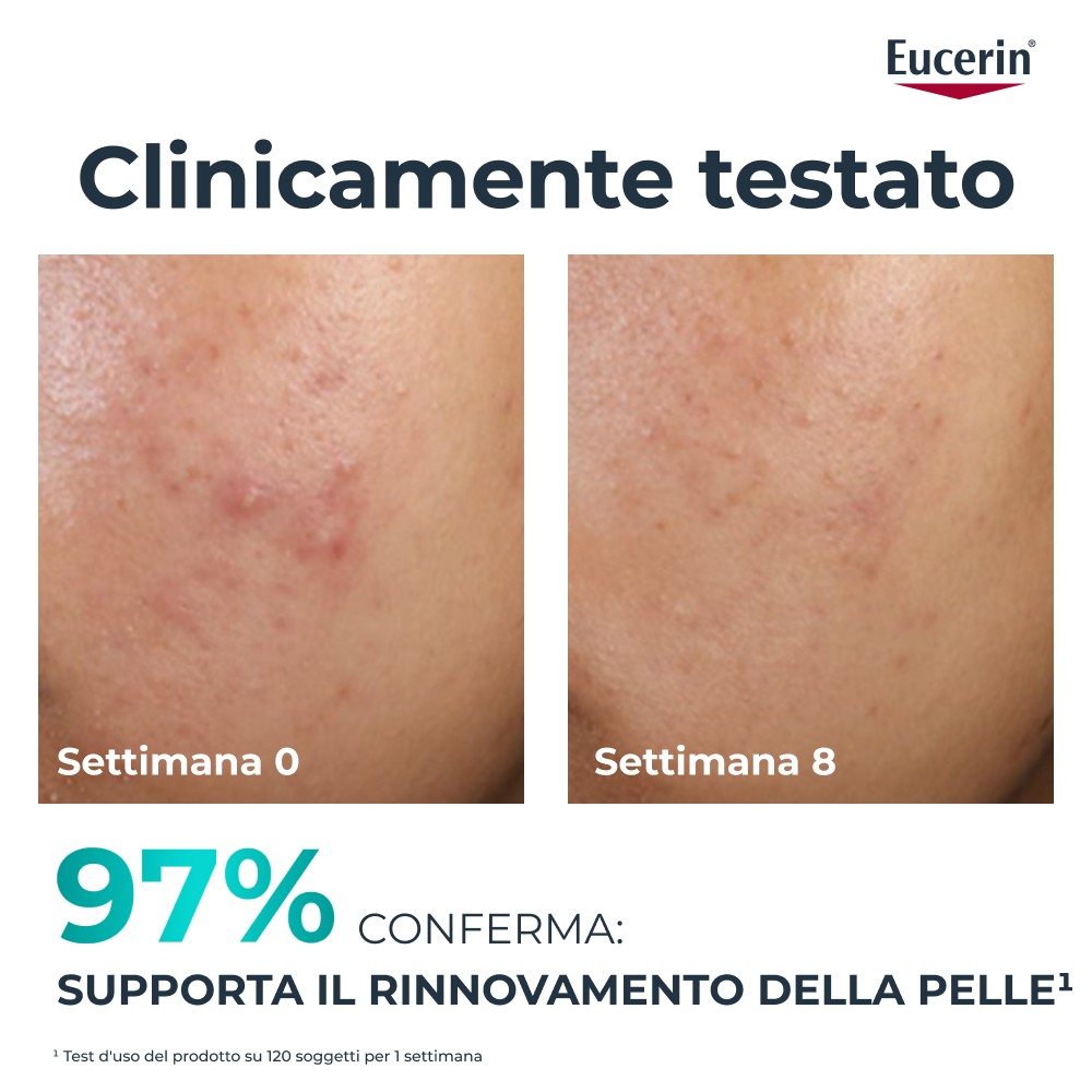 951091949 - EUCERIN DERMOPURE CLINICAL TRATTAMENTO RINNOVATORE 40 ML - 4840791_14.jpg