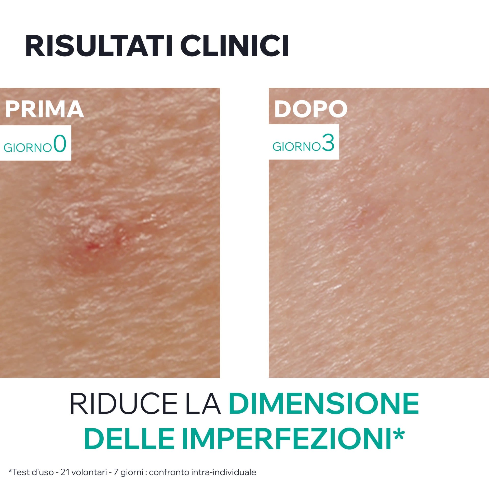 image - 988988580 - HYSEAC PATE SOS 15 G - 4782596_8.jpg