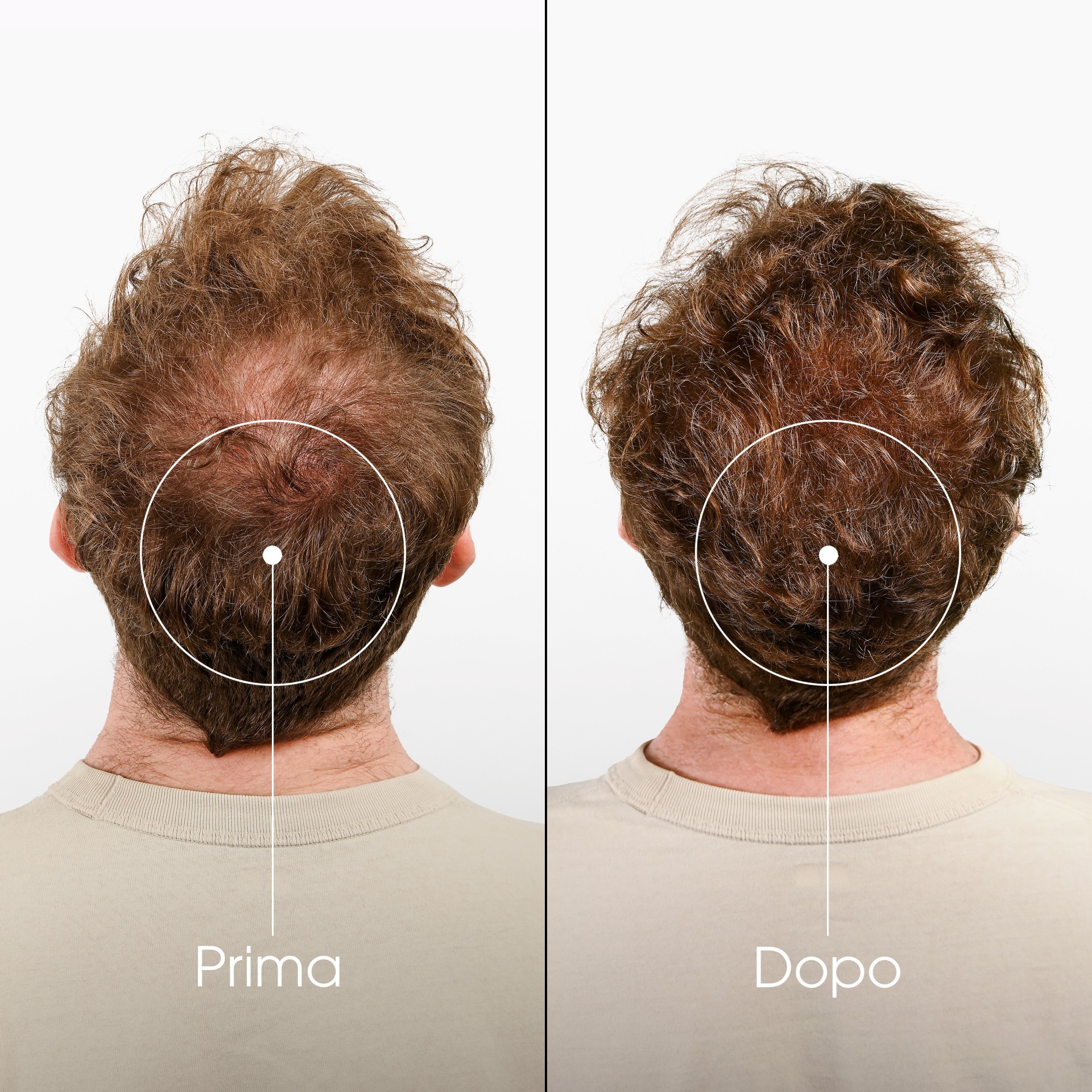 image - 981971070 - KLORANE SHAMPOO CHININA-STELLA ALPINA BIO 400 ML - 4707963_8.jpg