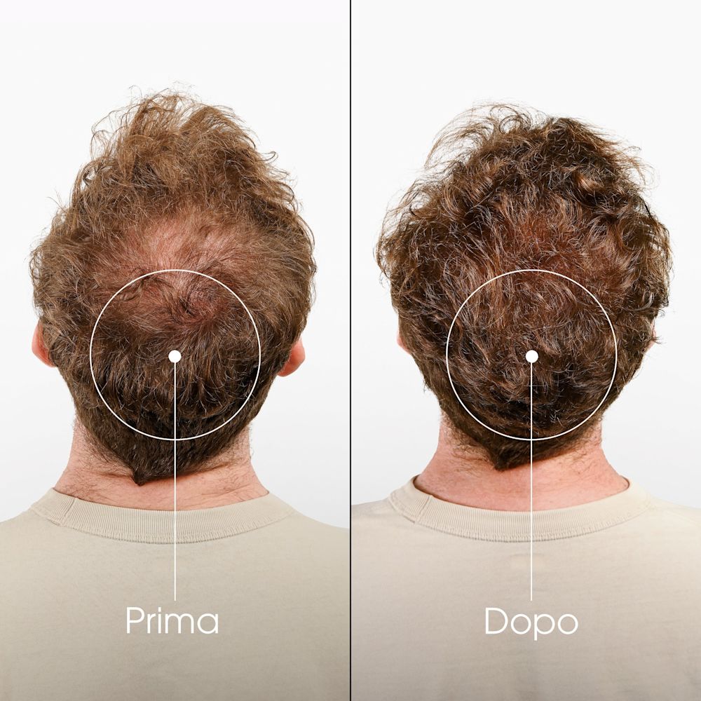 981971070 - KLORANE SHAMPOO CHININA-STELLA ALPINA BIO 400 ML - 4707963_8.jpg